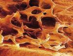 Mikroskopowe zdjęcie kości z osteoporozą