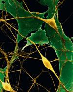 Ok. 100 mld neuronów (komórek nerwowych) znajduje się w mózgu człowieka 