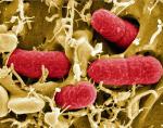 E.coli przyczyną zatruć 