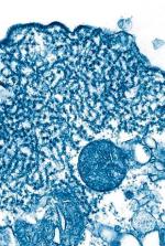 Wirus Nipah jest blisko spokrewniony z wirusem Hendra