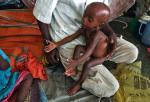 Ofiara głodu w Somalii, sierpień 2011 r. (fot. Farah Abdi Warsameh)