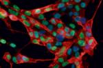 Mikroskopowy obraz  komórek wyhodowanych przez niemiecki zespół. Kolorowe znaczniki pomagają w identyfikacji tkanki zmodyfikowanej przez naukowców