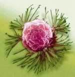 Tak wygląda komórka raka piersi pod mikroskopem. Jej słabe punkty wykryje badanie genetyczne 