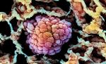 Komórki raka płuc widziane pod mikroskopem skaningowym. To na ich migracji skupili się matematycy 