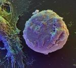 Komórki macierzyste naprawiające uszkodzone organy są nadzieją medycyny regeneracyjnej