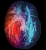 Infilitracja mózgu – rozrost glejaka w mózgu. Wyróżnienie w kategorii ilustracje. Fot. Science/M. Chamberland, D. Fortin, M. Descoteaux/ Sherbrooke Connectivity Imaging Lab