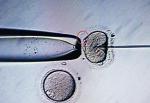 Poczęcie: komórka jajowa, plemnik  i mikromanipulator