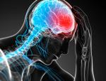 Typowe objawy migreny to ból i zawroty głowy, nadwrażliwość na światło, dźwięk, nudności, a nawet torsje