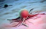 Tak naukowcy wyobrażają sobie początek choroby nowotworowej, gdy w organizmie pojawia się pierwsza zmutowana komórka 