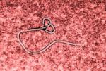 Niepozorna laseczka – tak wygląda śmiercionośny wirus Ebola pod mikroskopem