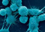 Tak wyglądają komórki raka prostaty pod mikroskopem elektronowym 