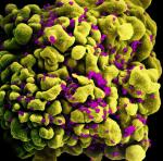 Tak wyglądają pod mikroskopem wirusy HIV atakujące komórkę układu odpornościowego