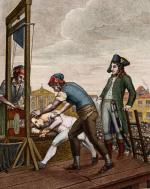 Francuski lekarz Julien Jean Cesar de Gallois   żyjący w XVIII wiecznej Francji doszedł do wniosku,  że równo odcięta gilotyną głowa mogłaby żyć jeszcze długo, gdyby zasilać ją natlenioną krwią. Stał się prekursorem myślenia o przeszczepie głowy