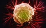 Rak piersi (obraz spod mikroskopu elektronowego) jest współczesną plagą kobiet. Polscy badacze dokonali odkrycia, które zwiększy szanse pań w walce z tą chorobą 