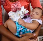 Dziecko cierpiące na mikrocefalię leczone w szpitalu uniwersyteckim w Recife w Brazylii
