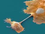 Portret zabójcy – komórka nowotworowa pod mikroskopem