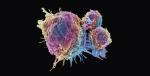 Limfocyty T atakują komórkę nowotworu – zdjęcie ze skaningowego mikroskopu elektronowego