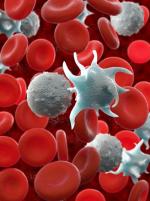 W przebiegu białaczki  dochodzi do powstawania nadmiernej liczby nieprawidłowych limfocytów. 