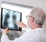 Co roku na raka płuc w Polsce umiera 23 tys. osób 