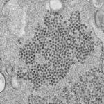 ≥Sferyczne wiriony enterowirusa D68 widoczne na zdjęciu spod mikroskopu elektronowego 
