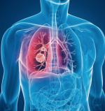 Płuca zaczynają boleć, gdy nowotwór jest już zaawansowany, a leczenie nie zawsze skuteczne 