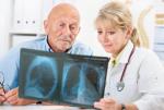 Najlepsze efekty w terapii raka płuca przynosi leczenie holistyczne  