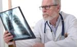 Rak płuca jest najczęstszym nowotworem złośliwym i pierwszą przyczyną zgonów na choroby nowotworowe w Polsce  