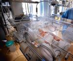 Noworodki mają obniżoną odporność – wskazują lekarze  i sugerują zawieszenie porodów rodzinnych   