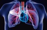W wyniku tętniczego nadciśnienia płucnego dochodzi do znacznego wzrostu ciśnienia krwi w krążeniu płucnym 