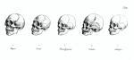 Wizerunki ludzkich czaszek. Na ich podstawie niemiecki antropolog prof. Johann F. Blumenbach (1752–1840) wyodrębnił pięć głównych ras