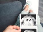 Zabiegi aborcji selektywnej jednego z płodów przeprowadza się najczęściej w Holandii. Są one poprzedzone konsultacjami z odpowiednikiem polskiej pomocy społecznej, z lekarzem i położną