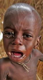 Państwa afrykańskie najbardziej dotknięte kryzysem będą potrzebowały rocznie 30 miliardów dolarów pomocy, by uzdrowić rolnictwo.Na zdjęciu: niedożywione dziecko w szpitalu w Maradi (Niger) 