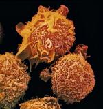 Komórki białaczkowe mogą rozpanoszyć się w szpiku kostnym