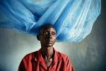 Pacjent szpitala dla gruźlików  w miejscowości Yrol w południowym Sudanie
