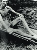 Wycieńczony jeniec z wyzwolonego japońskiego obozu, 1945 r.  