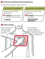 Już prościej się nie da - 100 uciśnięć klatki piersiowej na minutę 