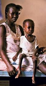 Mała Ruot  z  Sudanu, podobnie  jak prawie  50 procent  jej rówieśników, cierpi na ostre niedożywienie  
