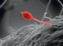 Gliocladium roseum to grzyby, które potrafią rozkładać celulozę.  W wyniku tej reakcji powstają podstawowe składniki paliwa dla silników spalinowych. Obraz  z mikroskopu elektronowego jest podkolorowany Bigger