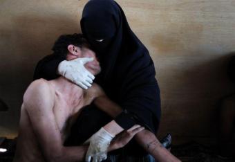 Oto zdjęcie roku według World Press Photo