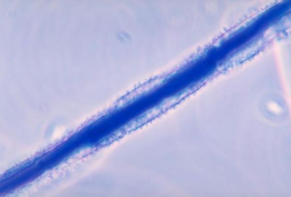 Aspergillus flavus - pleśń, która roznosiła klątwę